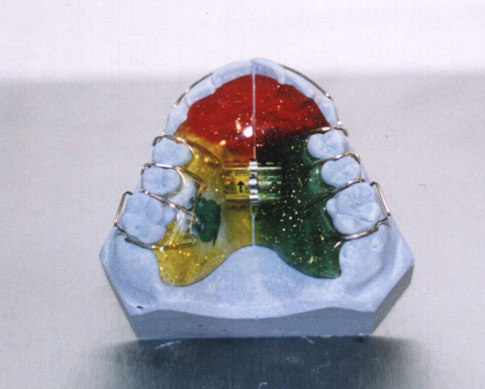 Beispiel 9